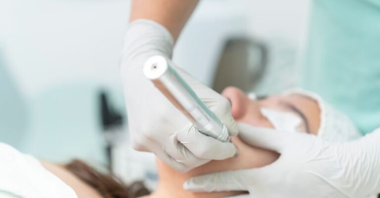 Praktisi kecantikan menggunakan alat microneedling pada wajah klien