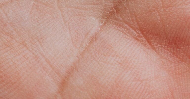 Close-up kulit wajah sensitif dan tipis, tanda barrier rusak